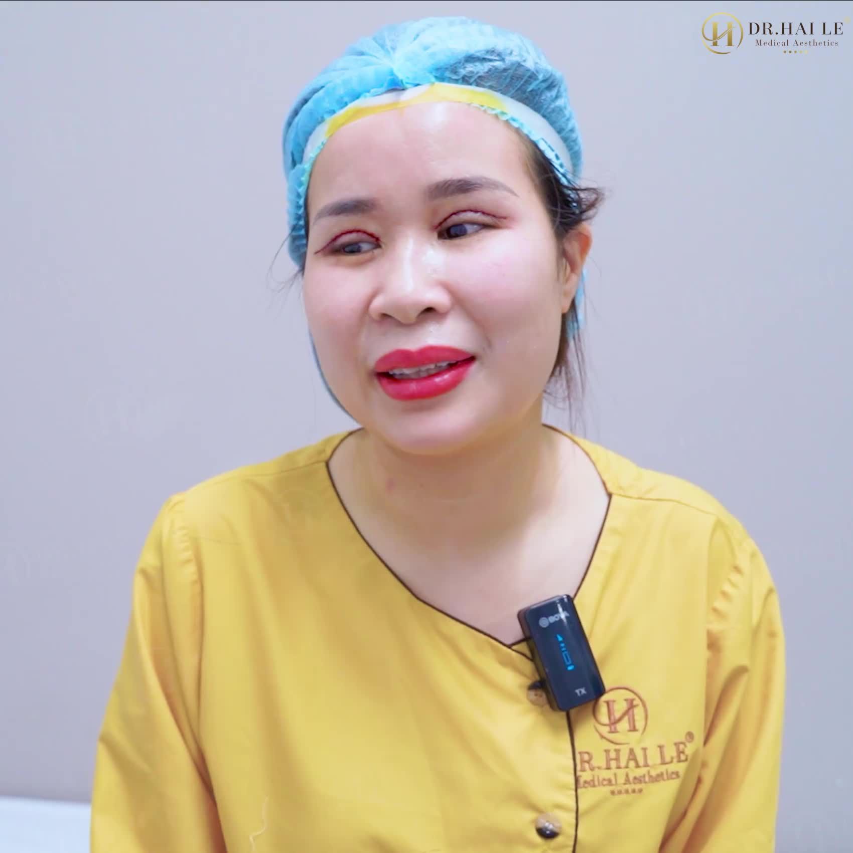 Cắt mí tại một cơ sở thẩm mỹ kém uy tín, hậu quả để lại cho đôi mắt của vị khách hàng là gì?