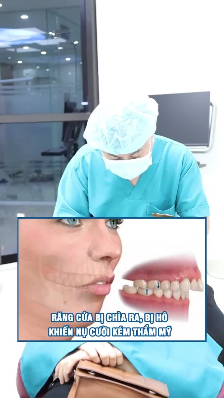 Mài răng cửa bị hô có ảnh hưởng gì không?