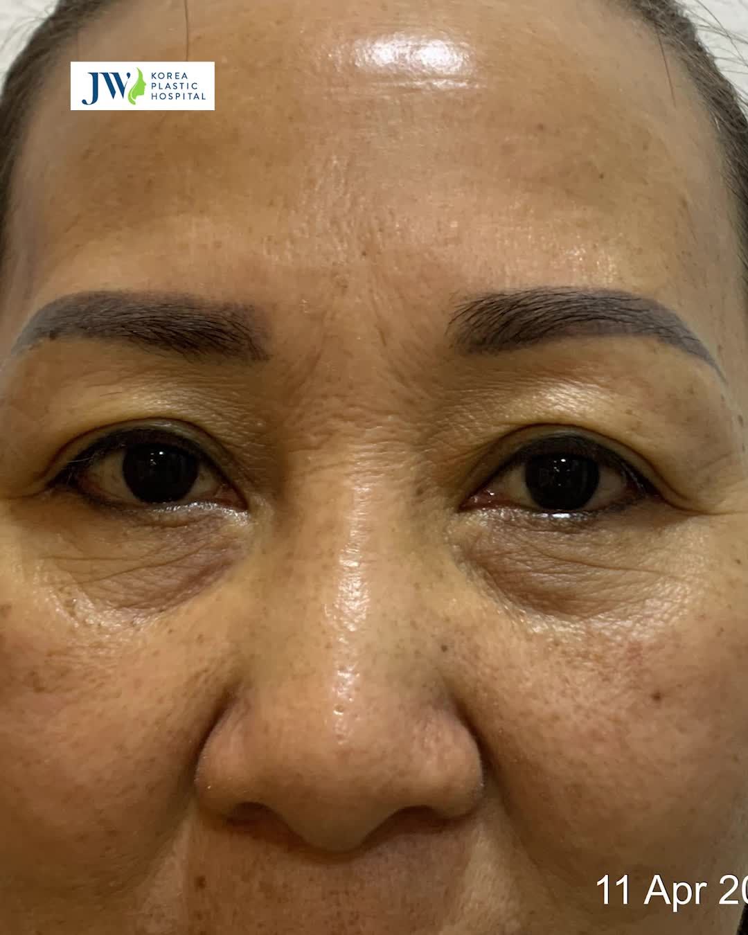 CẢI LÃO GƯƠNG MẶT 3M - BÍ THUẬT HỒI XUÂN KHÔNG TUỔI CỦA CHỊ EM TRUNG NIÊN