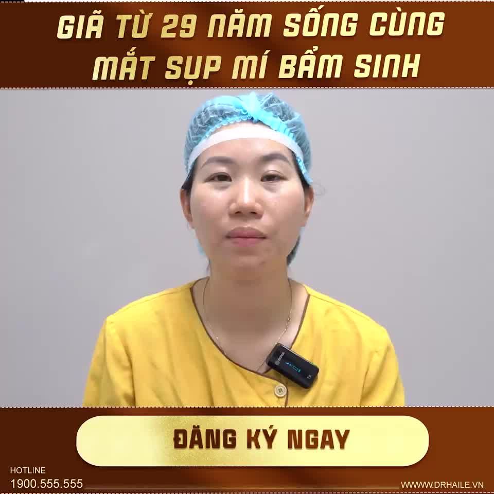 Sau 29 năm sống chung với đôi mắt sụp mí bẩm sinh, vị khách hàng đã thay đổi như thế nào khi đến với Dr.Hải Lê?