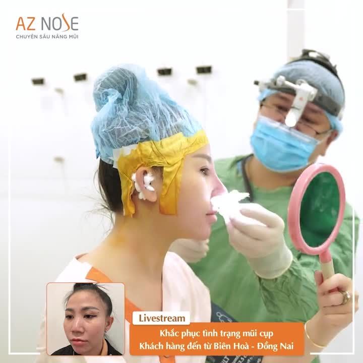 Khắc phục đầu mũi c.o r.út sau 3 lần nâng mũi bị h.ỏng