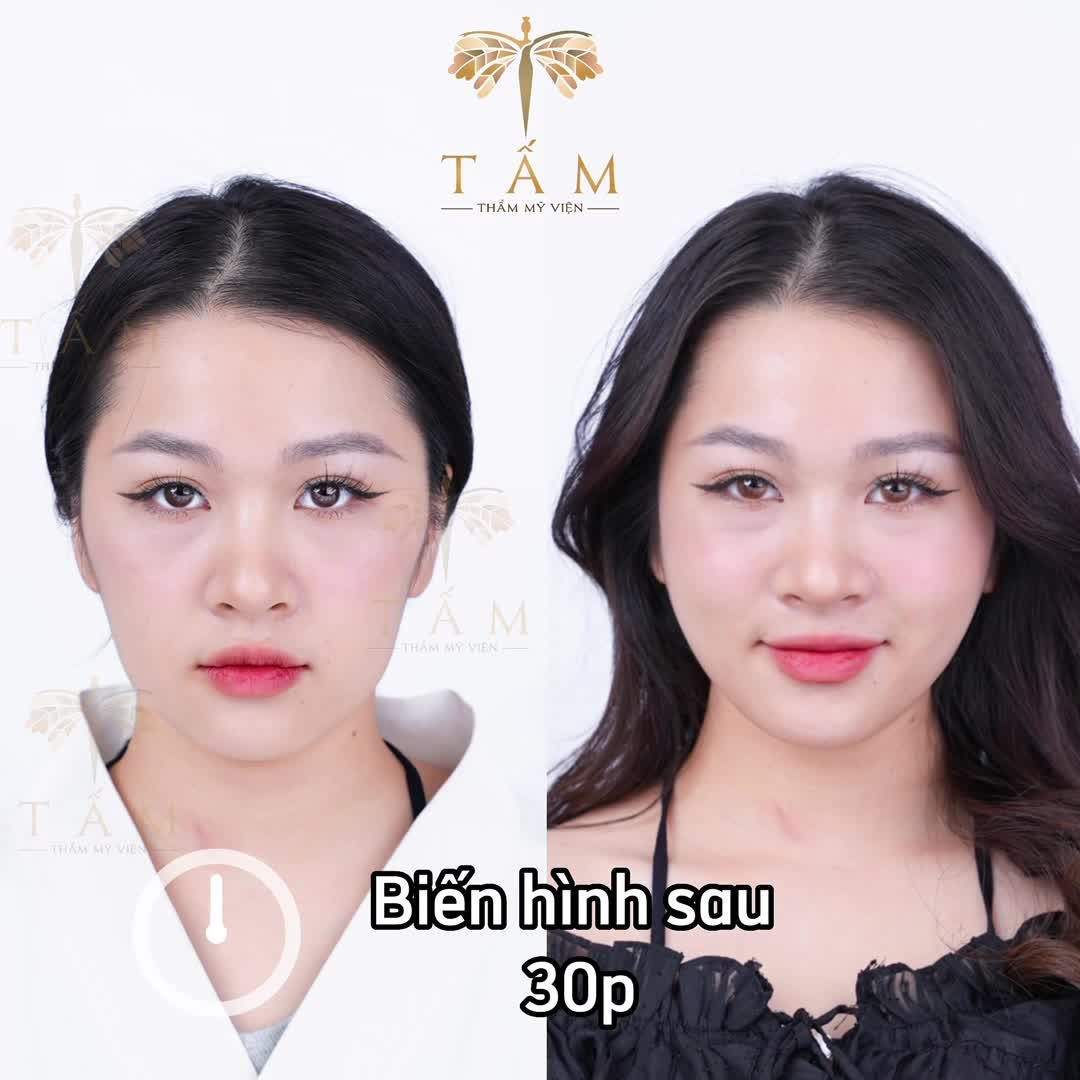 Lấy lại vẻ ngoài tươi tắn rạng ngời luôn là mong ước của bạn Thanh Trúc.