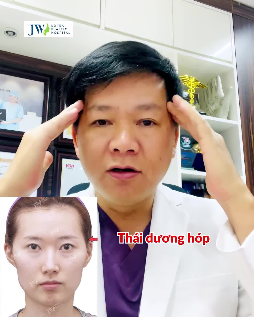 CẤY MỠ MẶT BABY FACE - TRẺ 10 TUỔI CHỈ TRONG 60 PHÚT
