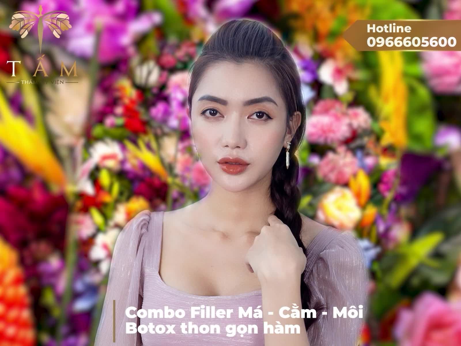 Combo Filler + Botox thon gọn hàm tại Tấm - Bộ đôi dịch vụ giúp các nàng đánh bật sự tự ti, lấy lại vẻ ngoài tươi trẻ