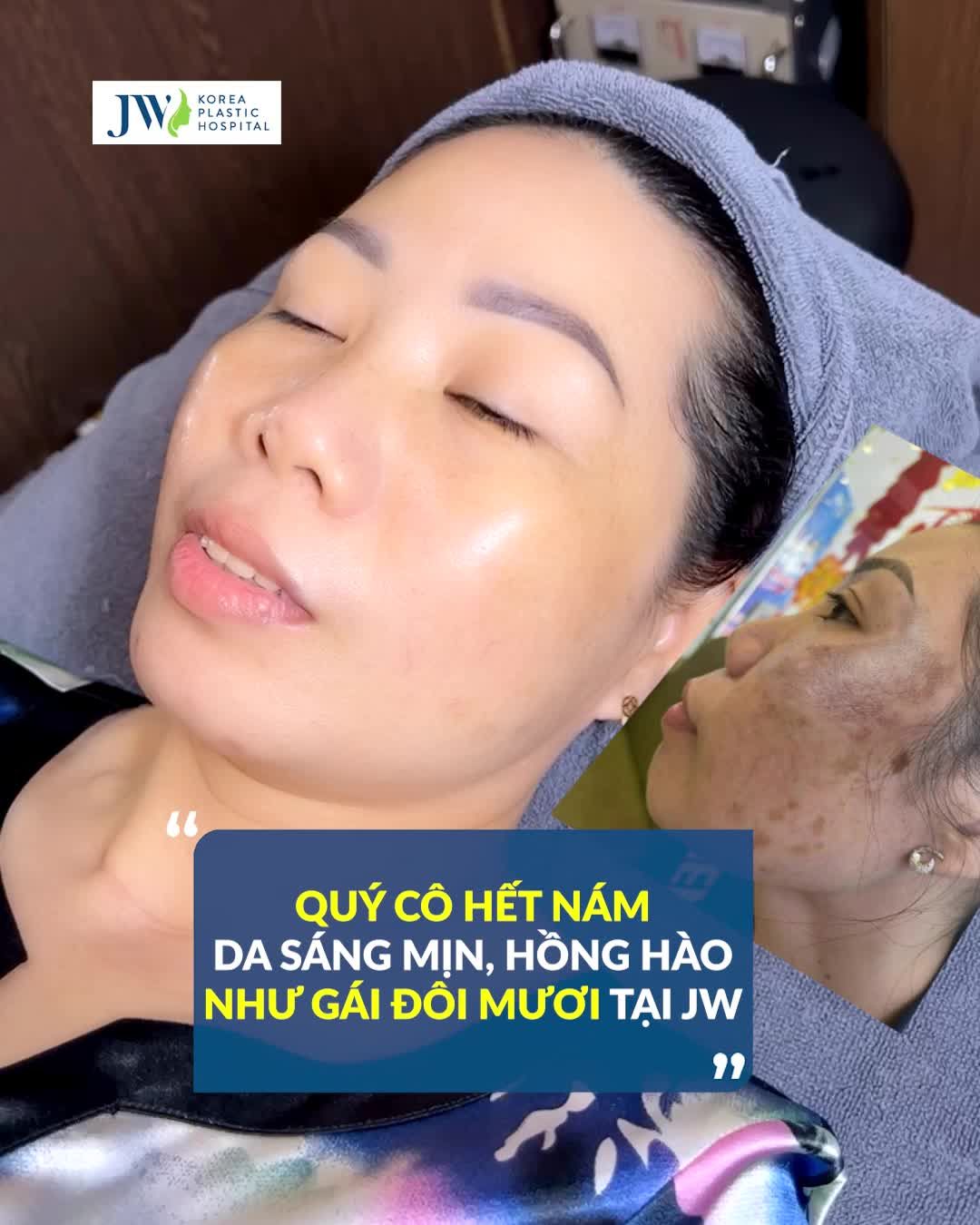 Chị em nào bị NÁM, ĐỐM NÂU thì ĐỪNG BỎ QUA VIDEO NÀY