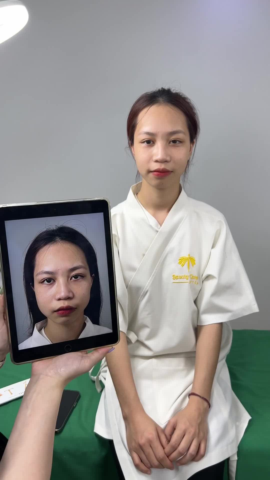 Ca Vline Perfect quay lại tái khám tại TMV Tấm