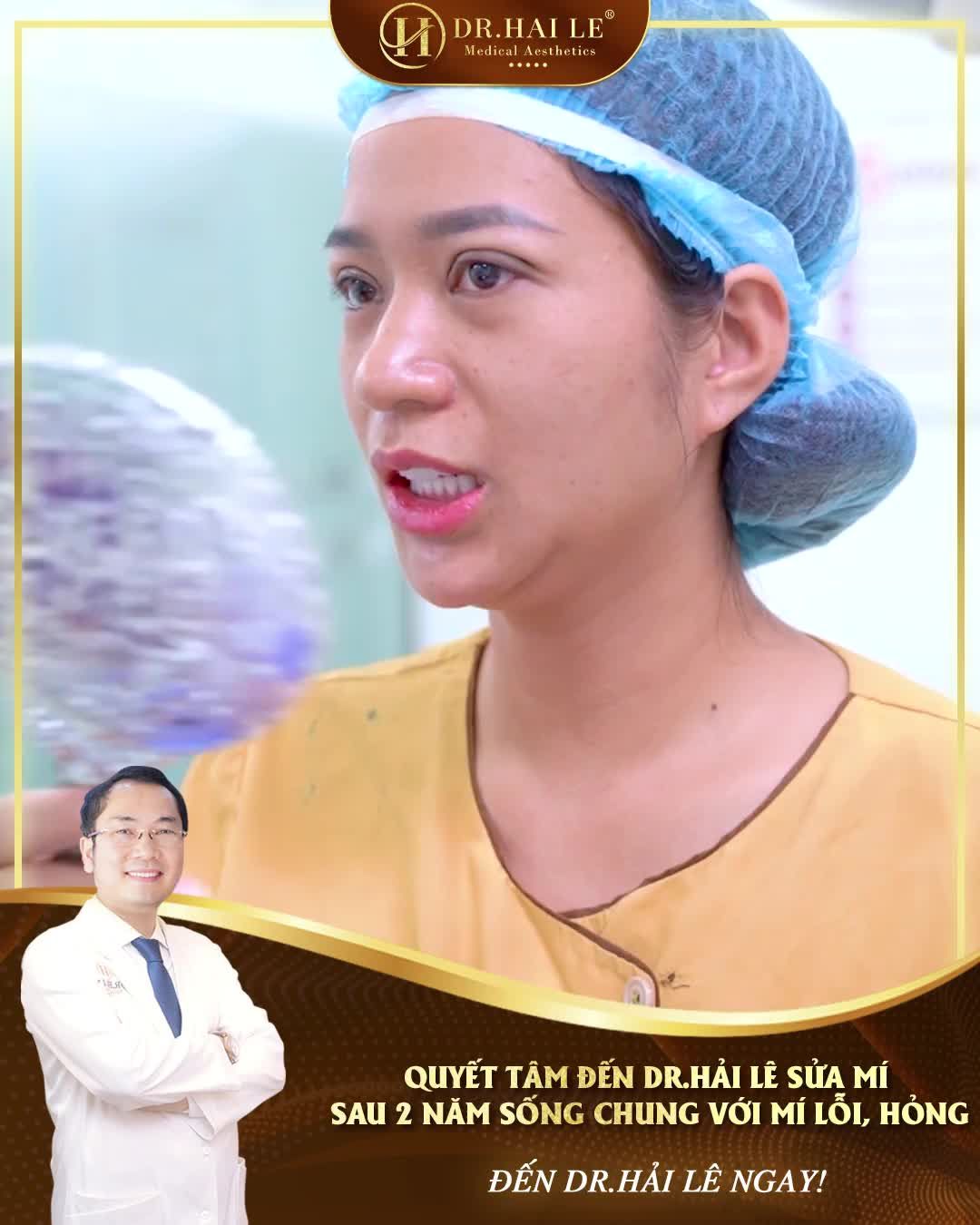 Sau 2 năm sống chung với “nỗi ám ảnh” mí lỗi, hỏng, vị khách hàng đã quyết tâm đến Dr.Hải Lê để sửa lại nếp mí, “giải cứu” đôi mắt của mình!