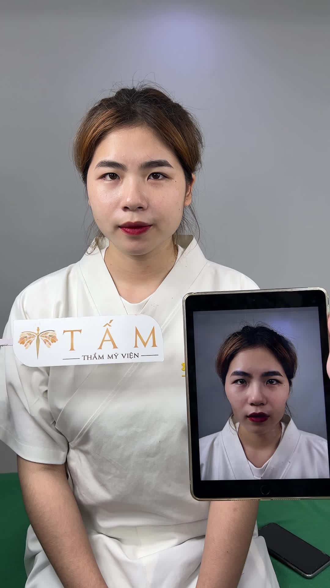 Bạn Hà Thu tự nhận thấy khuyết điểm lớn nhất trên gương mặt của mình là phần má bị hóp nhiều khiến bạn trông đứng tuổi, kém sắc.