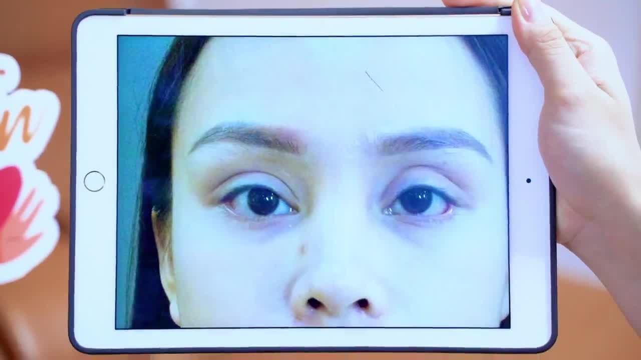 Đôi mắt lỗi hỏng được Dr.Hải Lê giải cứu thành công như thế nào? Cả nhà cùng đón xem