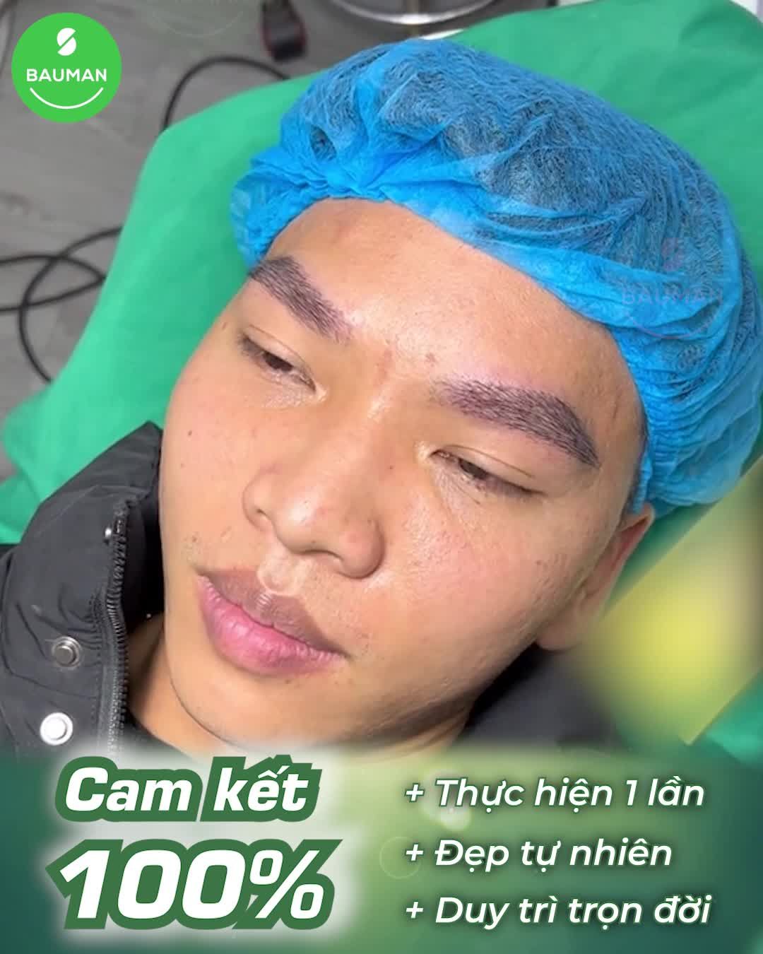 Lông mày thưa nhạt biến hóa thành phom dáng đẹp tự nhiên sau cấy