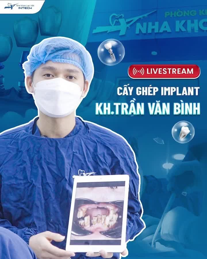 QUÁ TRÌNH CẤY GHÉP IMPLANT TOÀN HÀM TẠI LẠC VIỆT INTECH