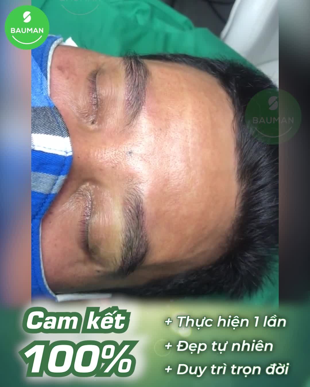 Không ngờ lông mày sau cấy lại thật và tự nhiên 99% như này, biết thế đi làm sớm hơn