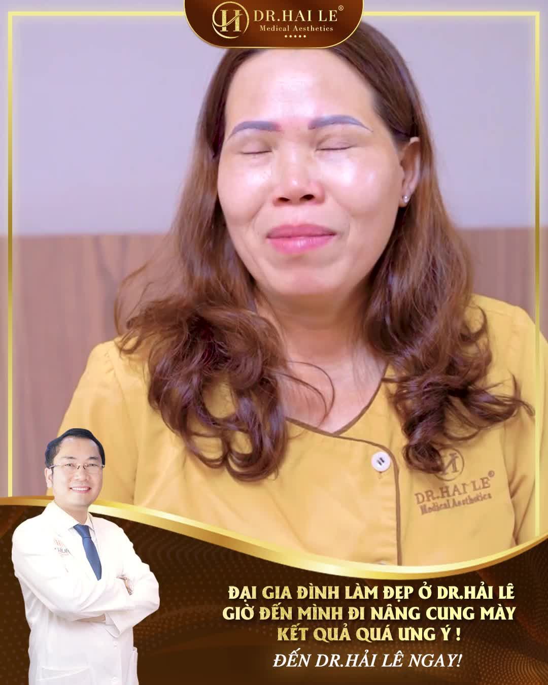 Da chùng, mỡ thừa chảy xệ, phải làm sao để khắc phục?  Nâng cung mày Dr.Hải Lê chính là giải pháp dành cho bạn!