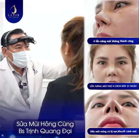 Khi niềm tin đặt không đúng chỗ và hậu quả là một chiếc mũi hỏng kèm theo những rủi ro không đáng có: