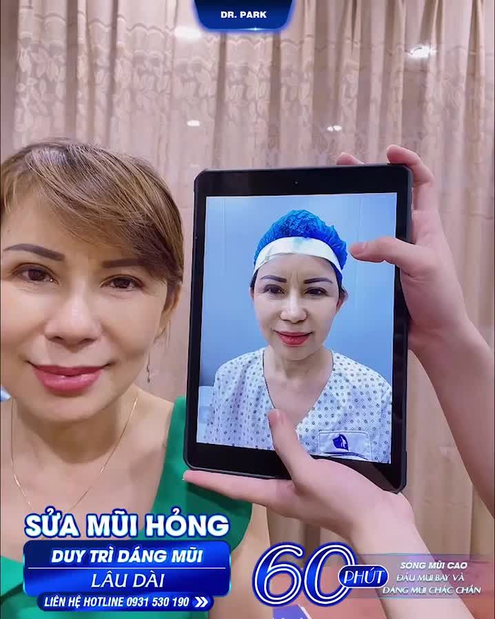 LÝ DO NÊN SỬA MŨI HỎNG CÀNG SỚM CÀNG TỐT?