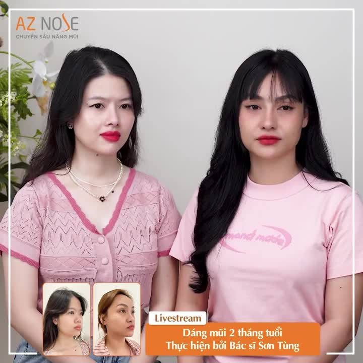 "Sợ đ.au" nhưng vẫn quyết tâm nâng mũi vì có bạn thân đồng hành
