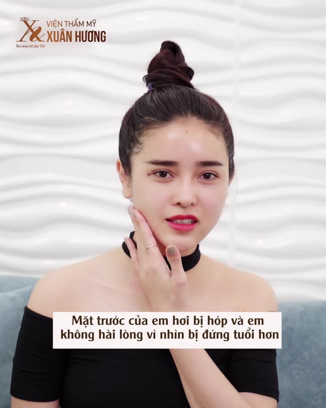 Cấy mỡ được thực hiện bởi đội ngũ bác sĩ hàng đầu VTM Xuân Hương, đảm bảo an toàn vô khuẩn theo quy trình của Bộ Y tế