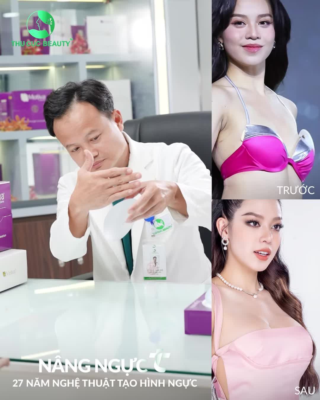 Xóa LÉP - Đón TỰ TIN chỉ sau 60P thực hiện Nâng ngực TC!!!