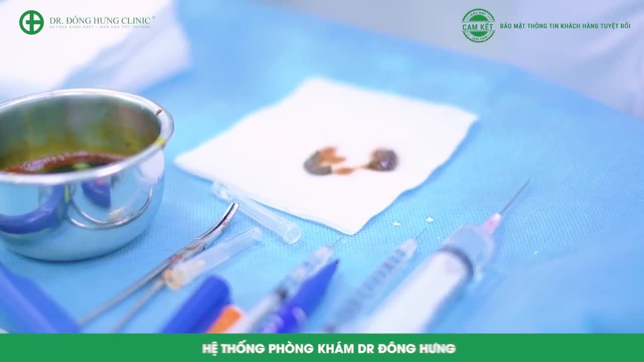 Đại tá - Bác sỹ chuyên khoa II Vũ Thắng chia sẻ về case cắt bỏ môi bé thâm đen - Đông Hưng Clinic