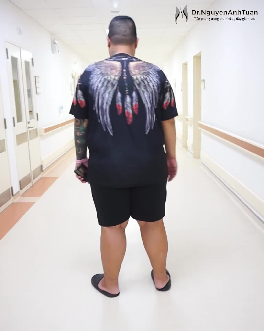 Tăng cân mất kiểm soát trong nhiều năm sinh sống ở nước ngoài, bệnh nhân Trung (153kg) hoang mang không tìm được giải pháp để thoát béo.