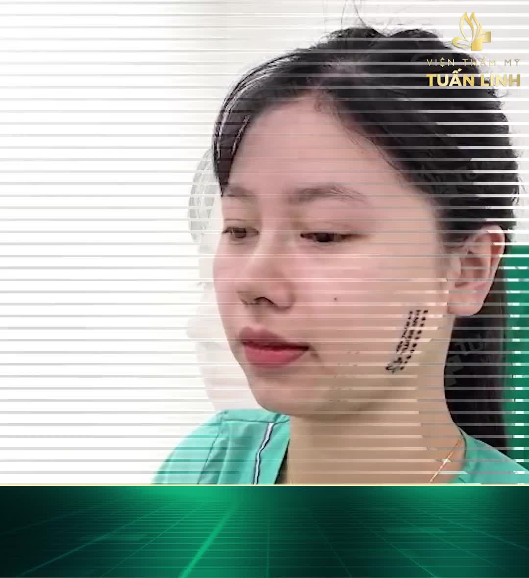 Bạn nào thích dáng mũi cao bay tự nhiên thì đừng bỏ qua Clip này nhé!!