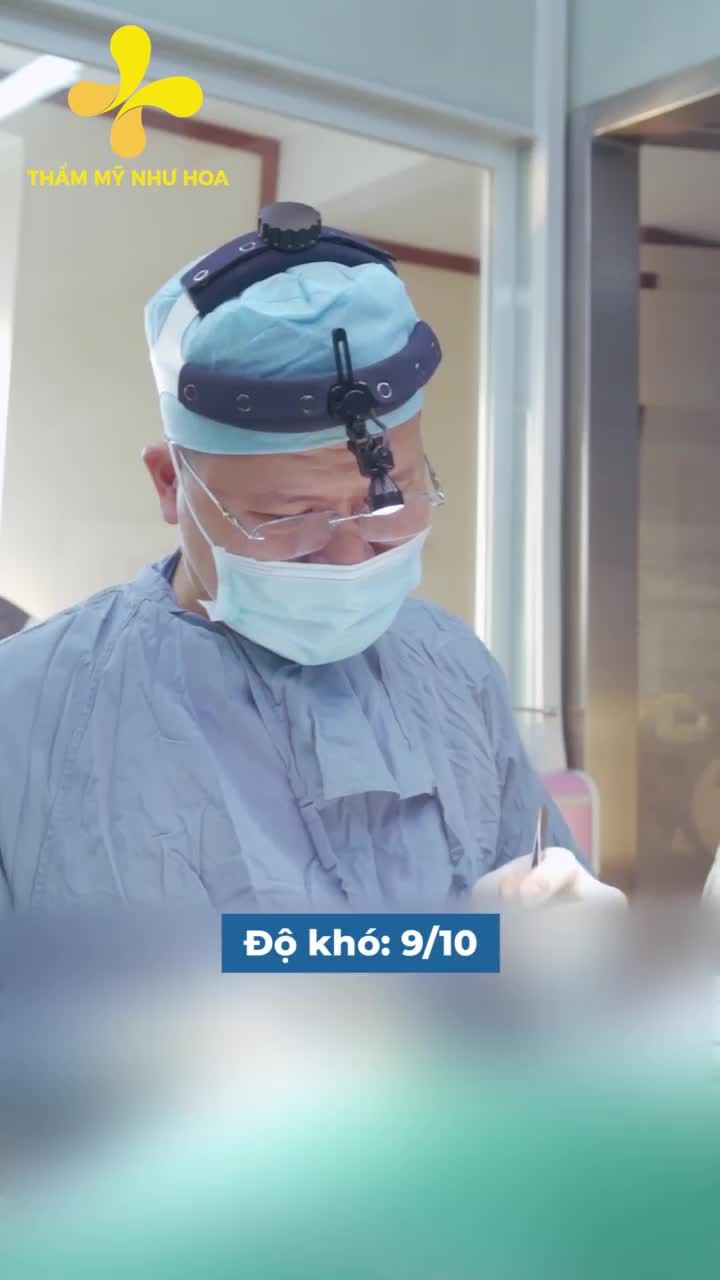Đánh giá độ khó ca nâng mũi sụn sườn - Khách hàng sửa mũi lần thứ 10.