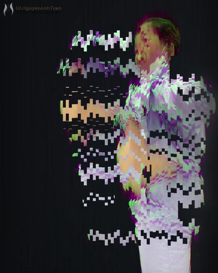 “Lớn tuổi rồi giảm cân chỉ mong khỏe chứ không mong đẹp!” - bệnh nhân Đỗ Thị Vì chia sẻ sau khi giảm 20kg bằng phương pháp thu nhỏ dạ dày.