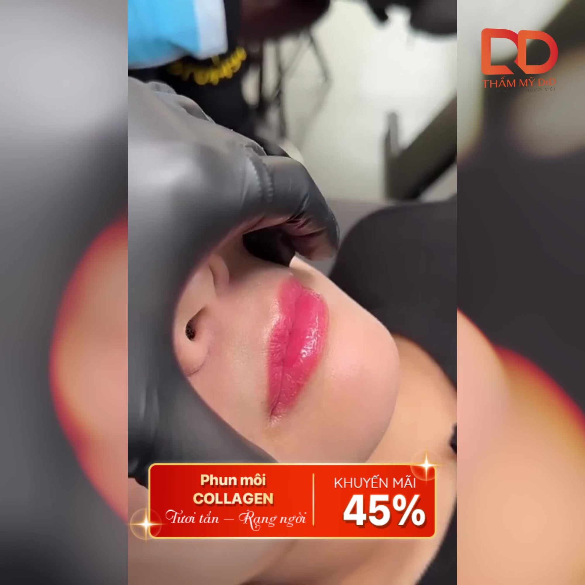 PHUN MÔI - BIẾN HÌNH ĐÔI MÔI KHÔNG KHÓ