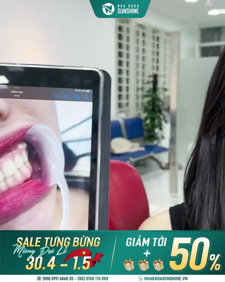 Làm răng sứ thẩm mỹ không lo về giá