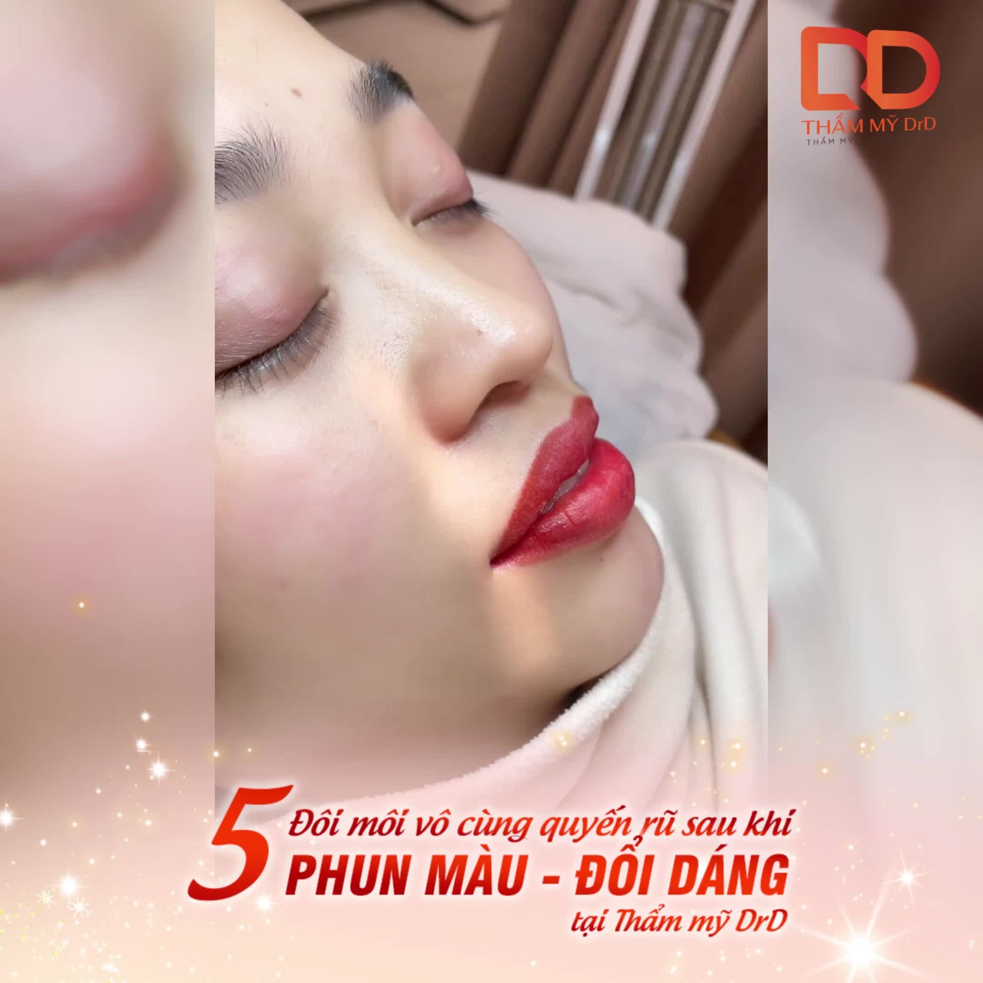 ĐIỂM DANH 5 ĐÔI MÔI PHUN MÀU SIÊU ĐẸP TẠI THẨM MỸ DRD