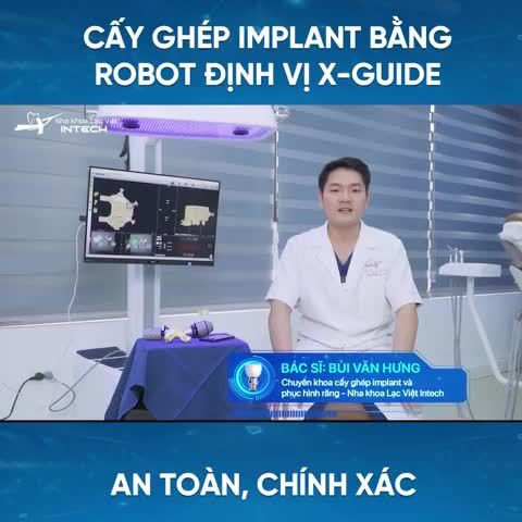 QUÁ TRÌNH CẤY GHÉP IMPLANT BẰNG ROBOT ĐỊNH VỊ X-GUIDE DIỄN RA NHƯ THẾ NÀO?