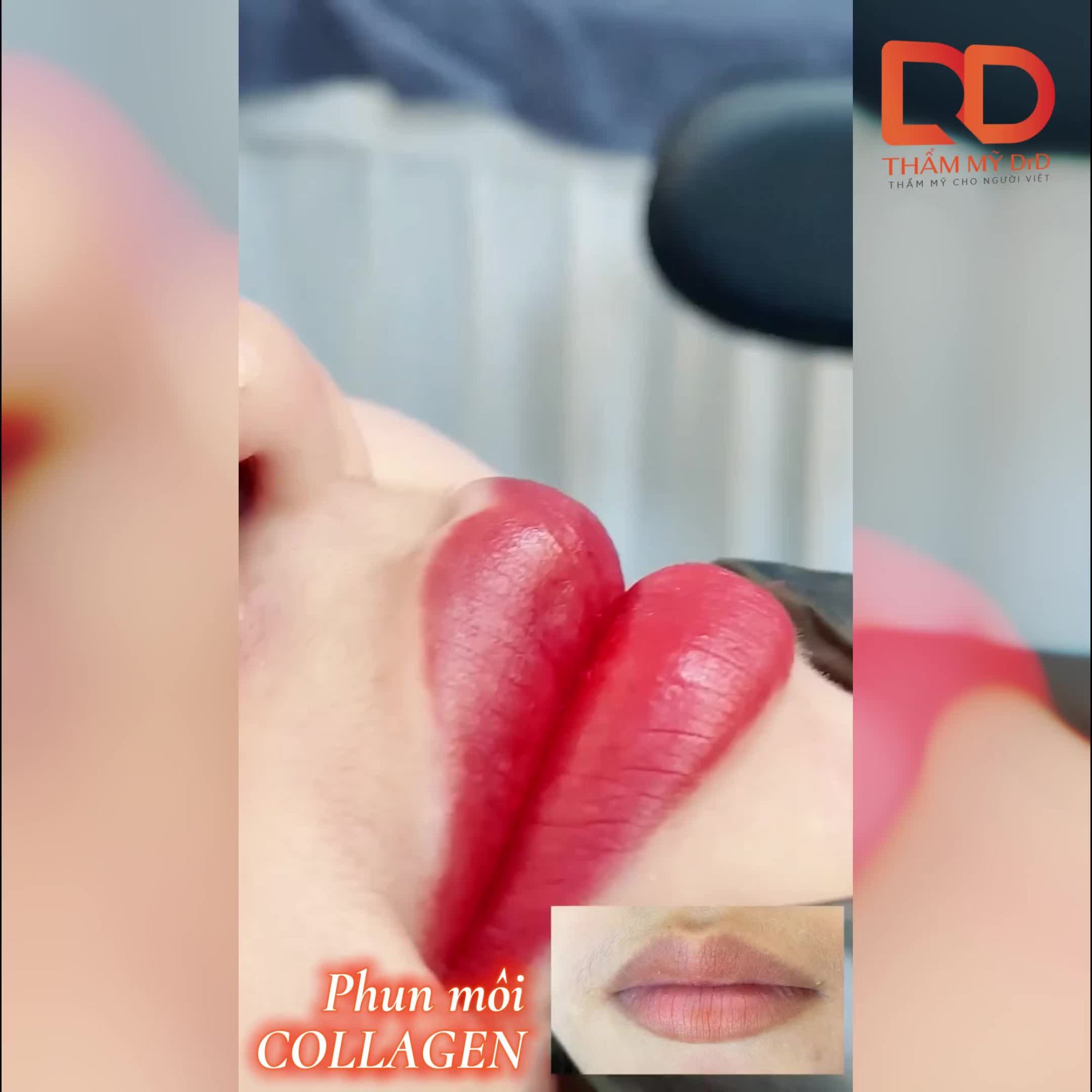 ĐÔI MÔI XINH ĐẸP LÀM XAO XUYẾN LÒNG NGƯỜI