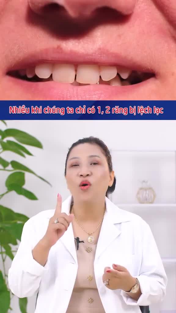 TRƯỜNG HỢP NÀO CÓ THỂ NIỀNG RĂNG 1 HÀM?