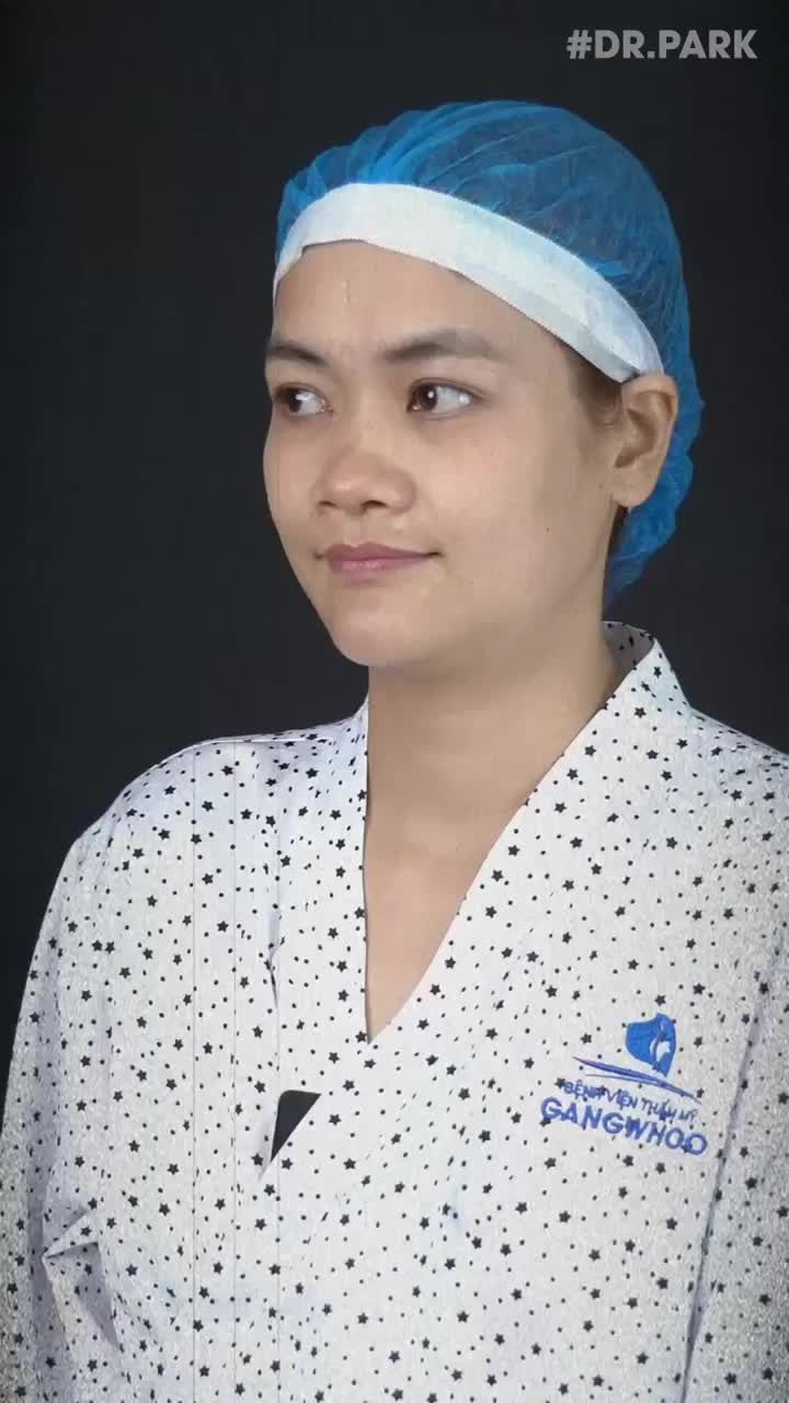 BẠN ĐÃ BIẾT ĐẾN ƯU ĐIỂM CỦA NÂNG MŨI CẤU TRÚC
