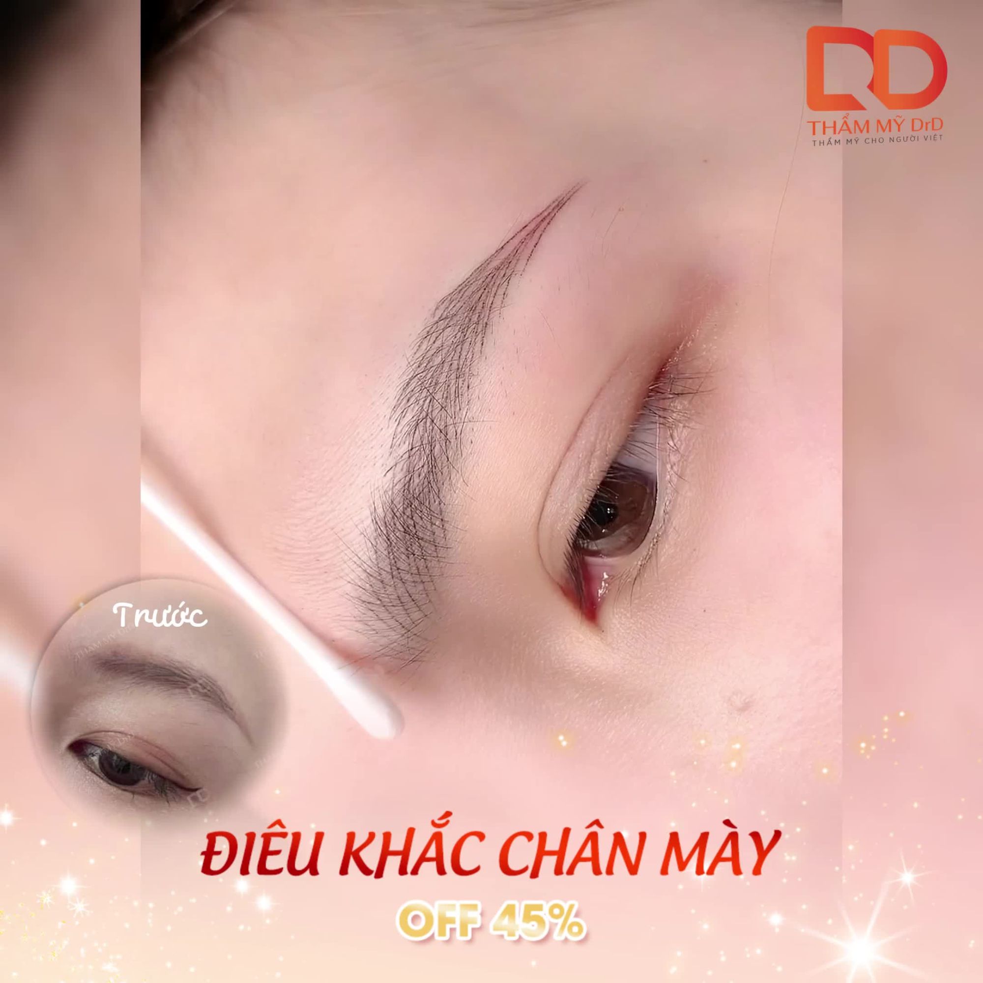 KẾT QUẢ CA ĐIÊU KHẮC CHÂN MÀY SANG – XỊN – MỊN!