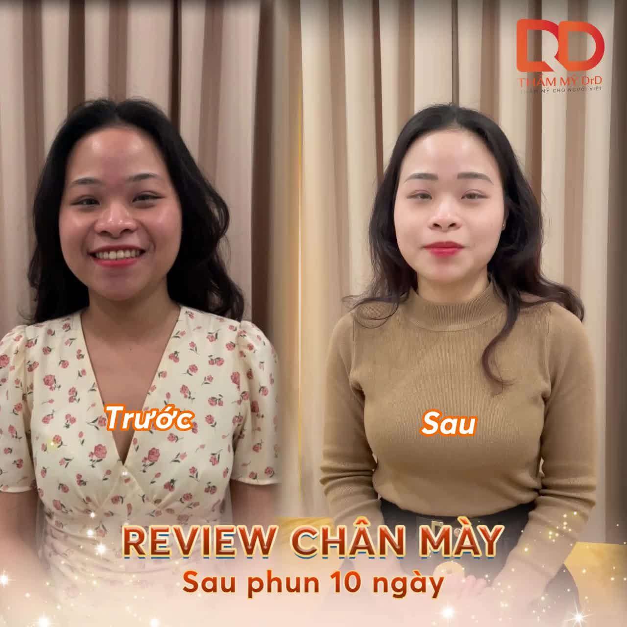 Chân mày sau phun 10 ngày