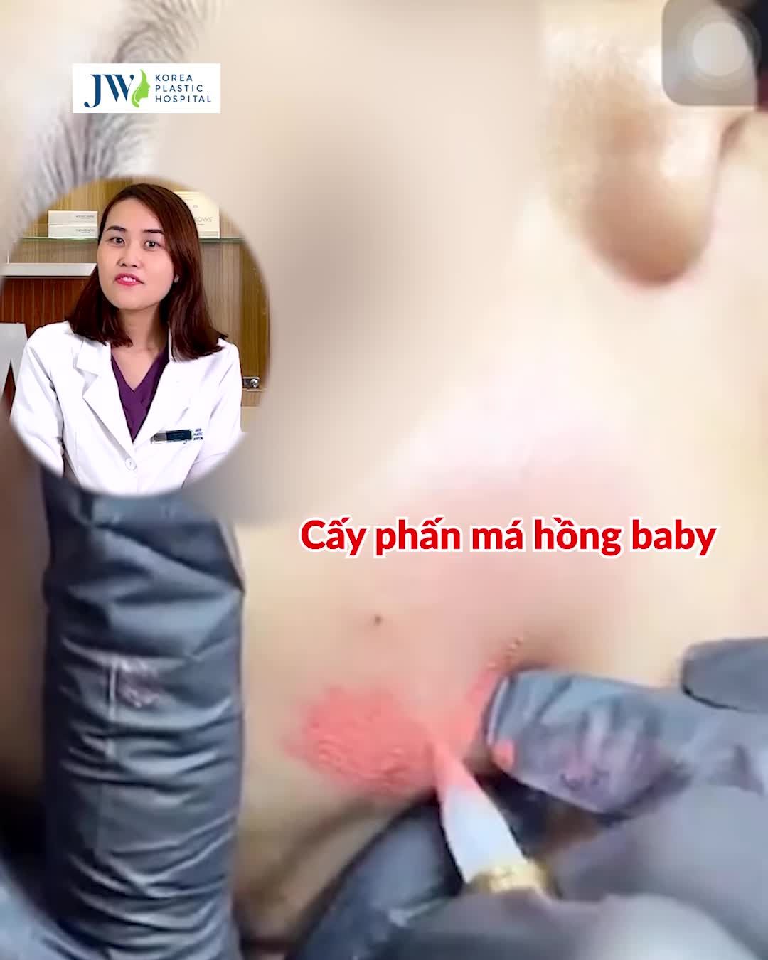 SỰ THẬT VỀ PHƯƠNG PHÁP LÀM ĐẸP CẤY MÁ HỒNG BABY ĐƯỢC GIỚI TRẺ LĂNG XÊ