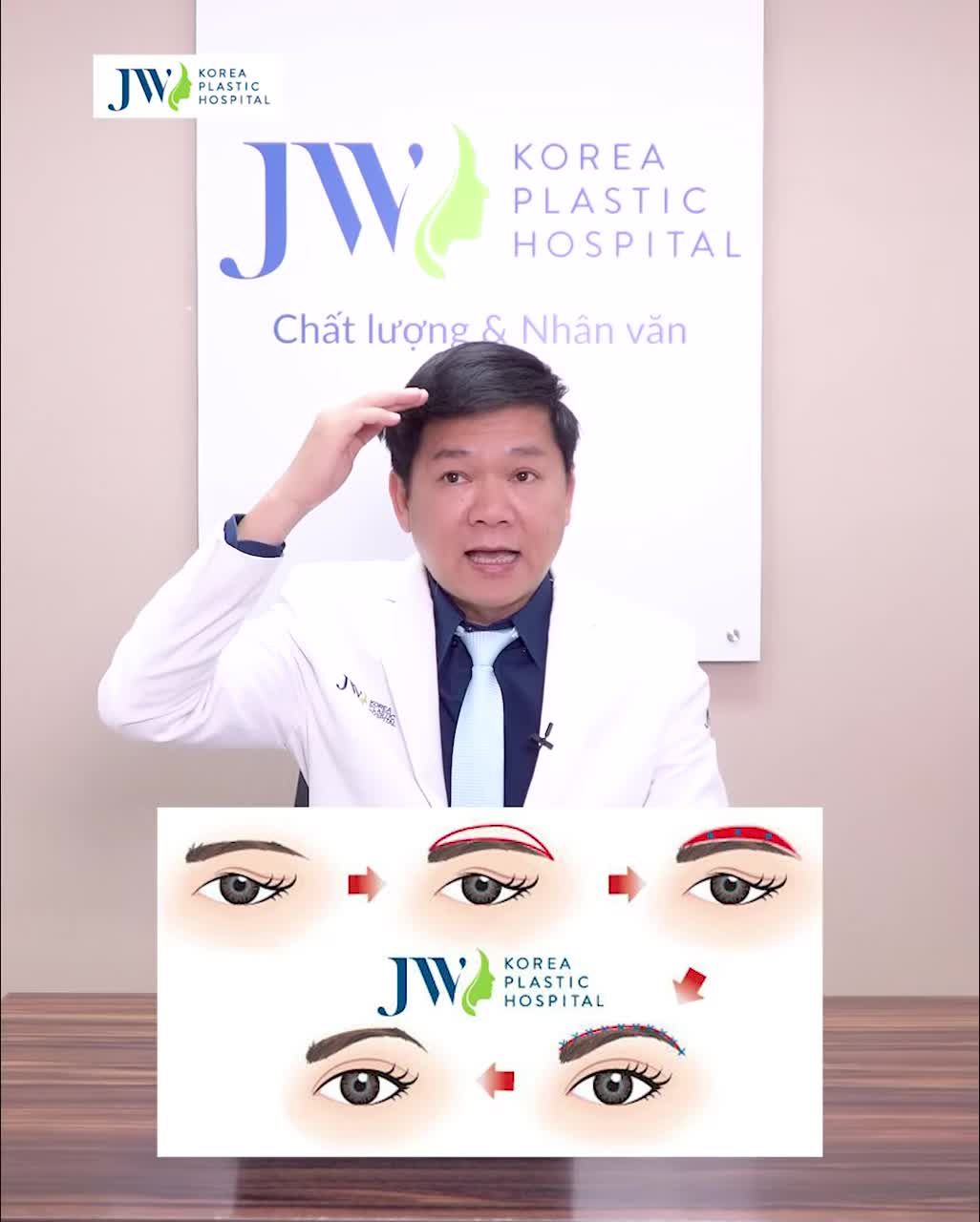 TREO CHÂN MÀY - ĐÔI MẮT TƯƠI TRẺ, HỒI XUÂN NHAN SẮC