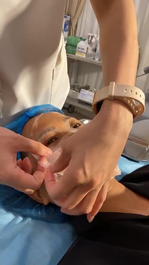 Khách hàng điều trị buổi thứ 2 trong gói liệu trình điều trị nám Laser + Mesotherapy.