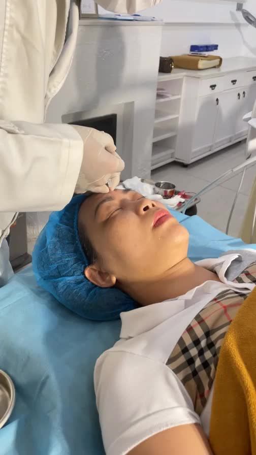 Khách hàng tiêm xoá nhăn vùng nhau mày (cau mày)