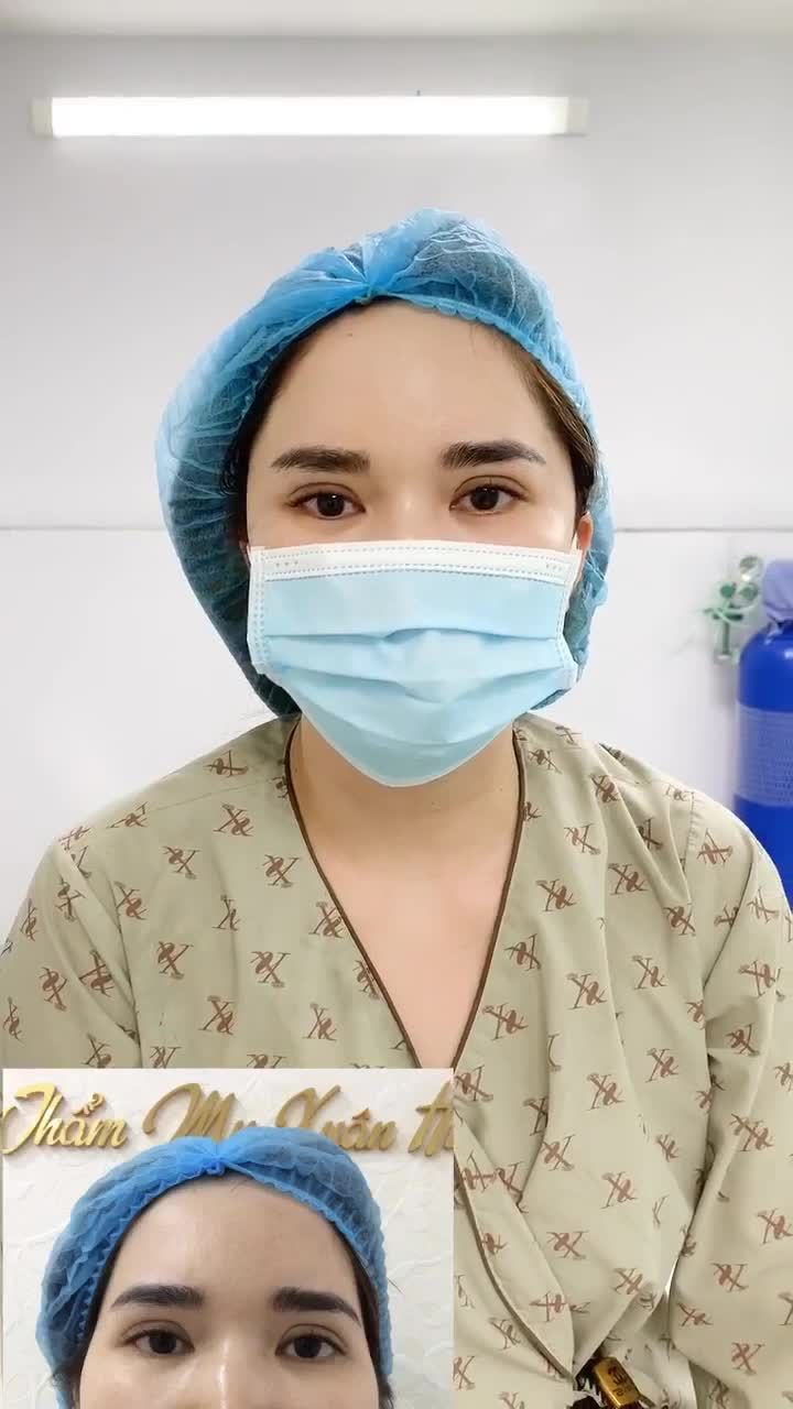 " Biết độn thái dương đẹp và không đau như này, chị đã đi làm sớm hơn rồi" Chị khách hàng chia sẻ.