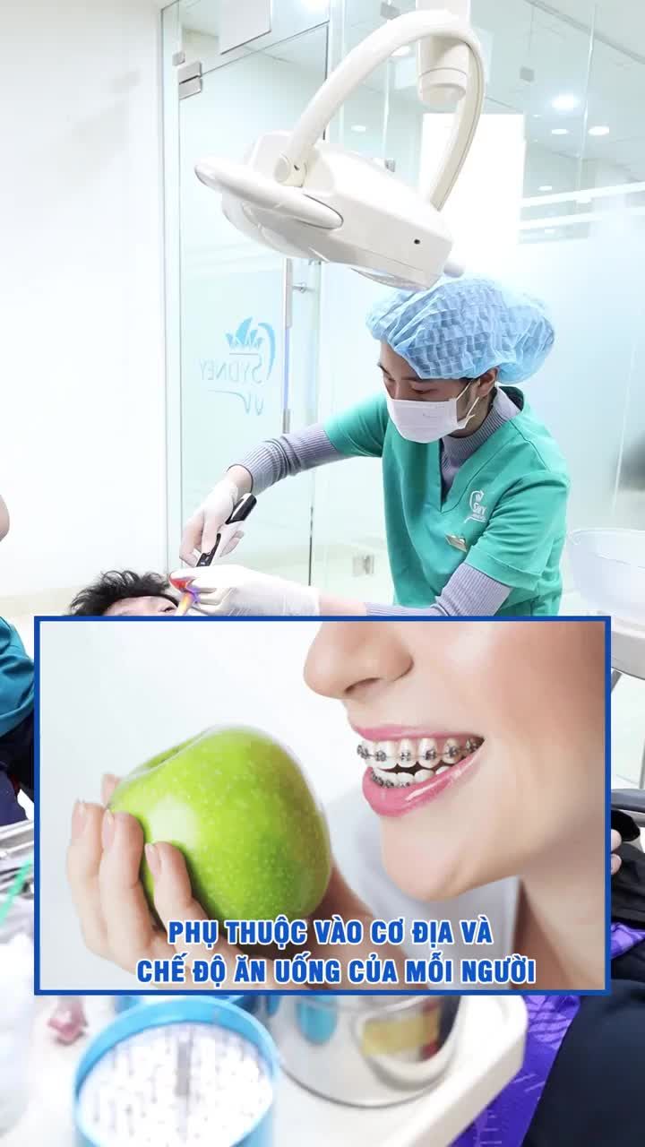 Niềng răng giảm cân có đúng không?