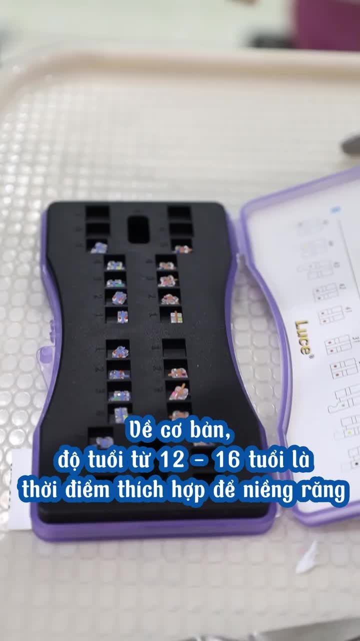  Độ tuổi từ 12 - 16 tuổi là thời điểm thích hợp để niềng răng. Nhưng nếu bỏ lỡ giai đoạn này thì vẫn có thể thực hiện nếu cấu trúc răng miệng còn chắc khoẻ.