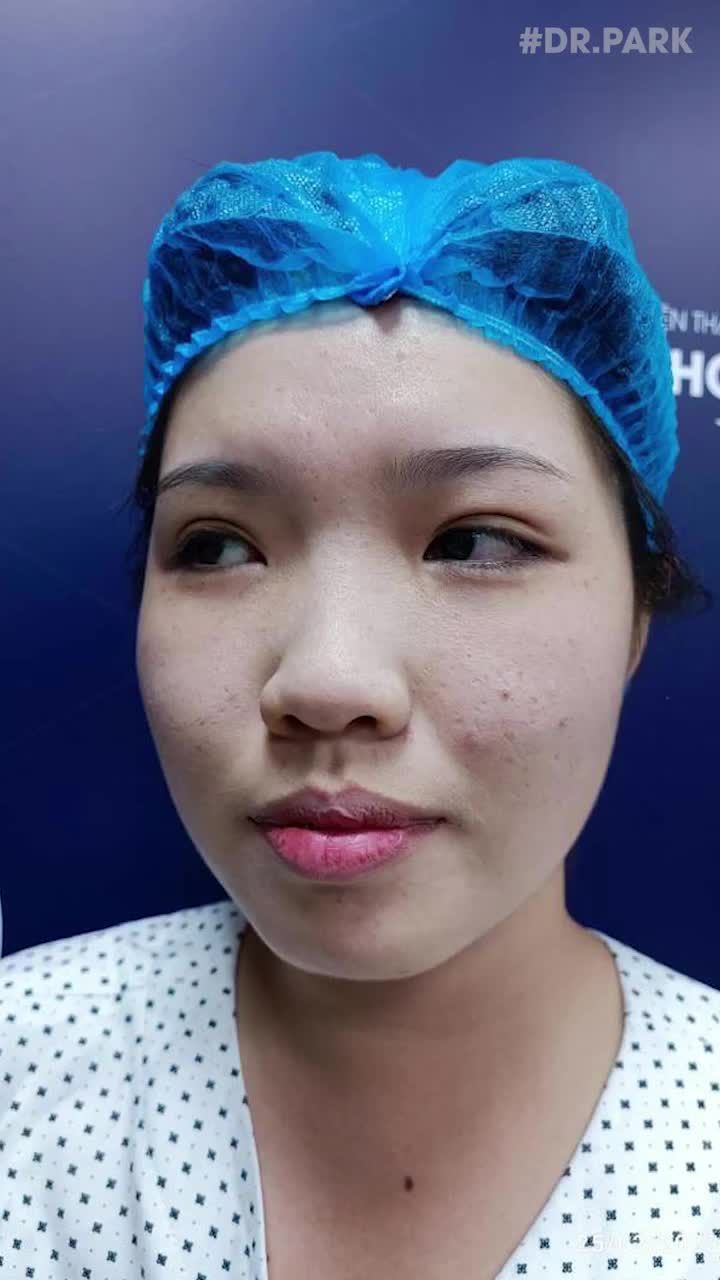 MŨI CẤU TRÚC DÀNH CHO AI?