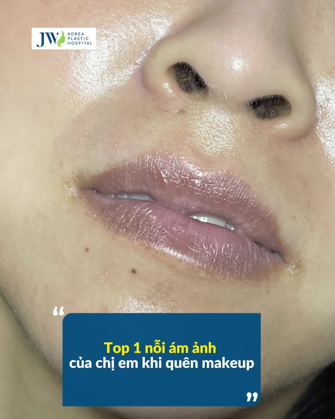 MÊ MẨN KẾT QUẢ PHUN MÔI TƯƠI THẮM, CĂNG MỌNG TẠI JW