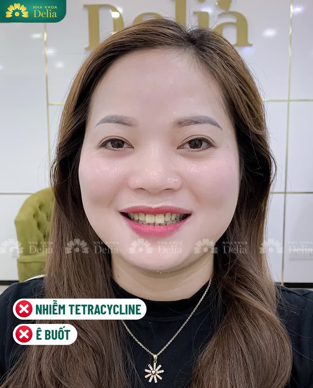Hạnh phúc là khi mình được tỏa sáng cùng nụ cười rạng rỡ trên môi mỗi ngày.
