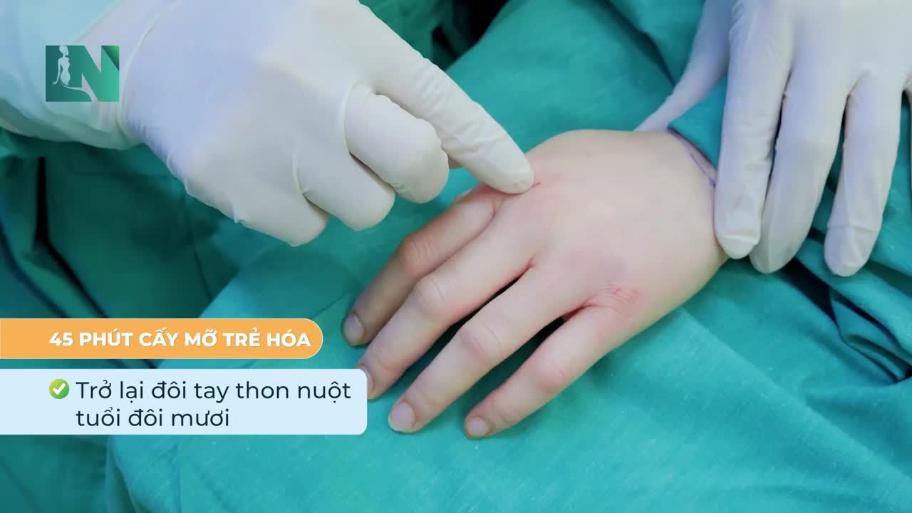 Giải pháp trẻ hoá đôi tay thô ráp, da nhăn nheo, ngón tay gầy guộc chỉ sau 45 phút bằng  cấy mỡ tự thân.