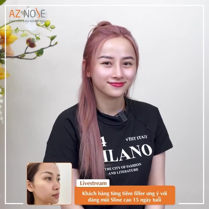 Dáng mũi mất cân đối do t.iêm filler, khách hàng K. thay đổi thế nào sau khi nâng mũi cấu trúc?