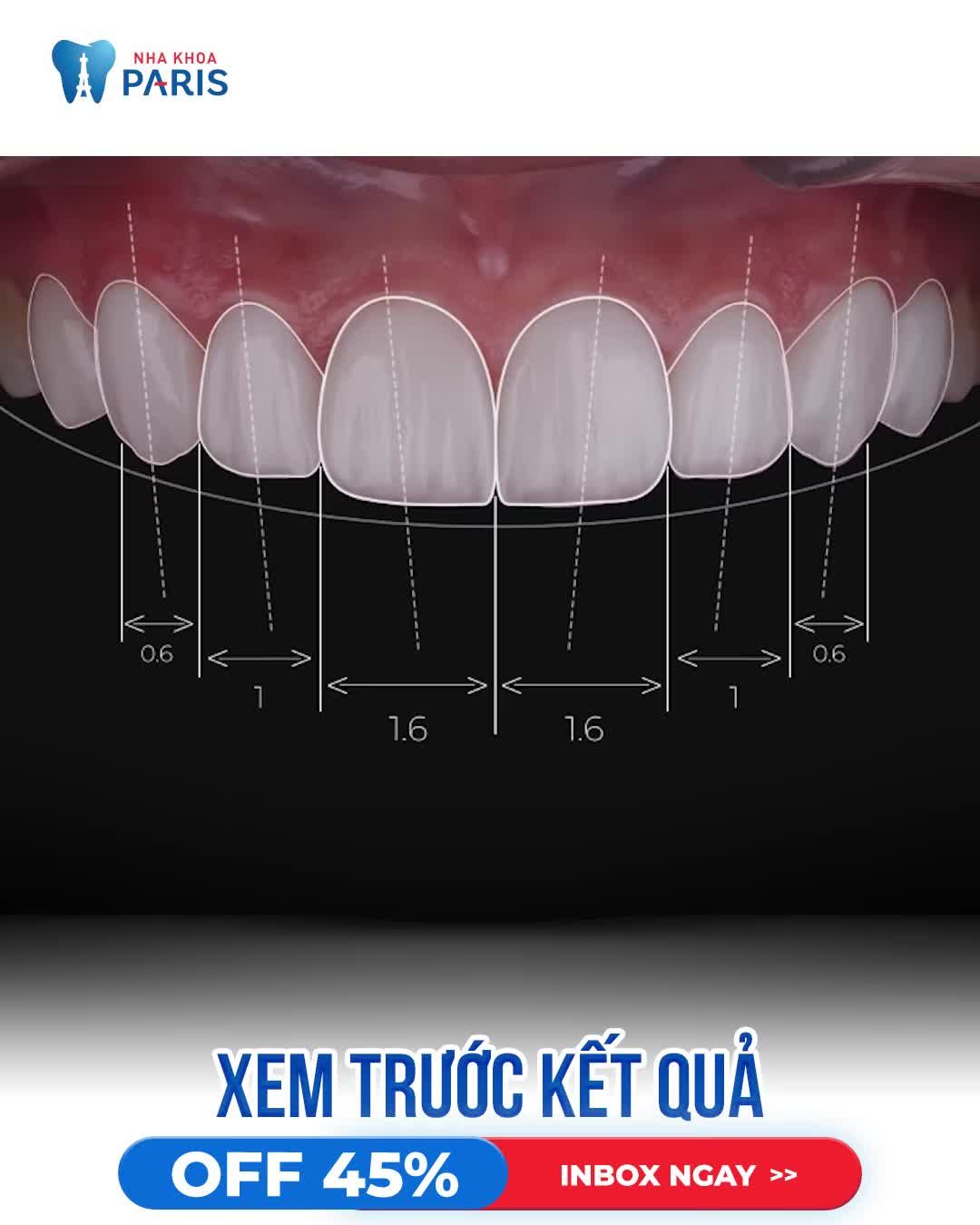 Biến Hình - Xem trước kết quả bọc răng sứ
