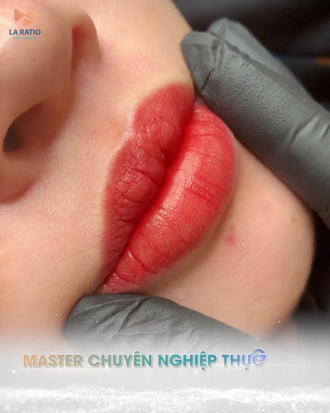 La Ratio vừa thực xong ca phun môi Collagen cho khách yêu. Đây là phương pháp cung cấp collagen, nuôi dưỡng cho môi thêm phần ngọt ngào